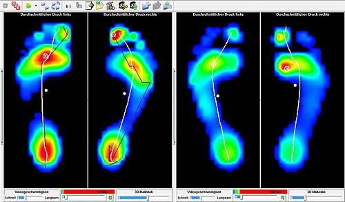Zdravá dětská noha